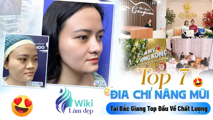 Top 7 Địa Chỉ Nâng Mũi Tại Bắc Giang Top Đầu Về Chất Lượng