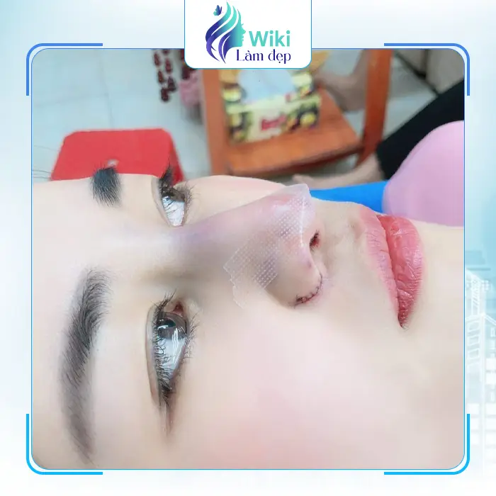 Top 7 Địa Chỉ Nâng Mũi Tại Bắc Kạn Uy Tín, An Toàn Và Được Đánh Giá Cao