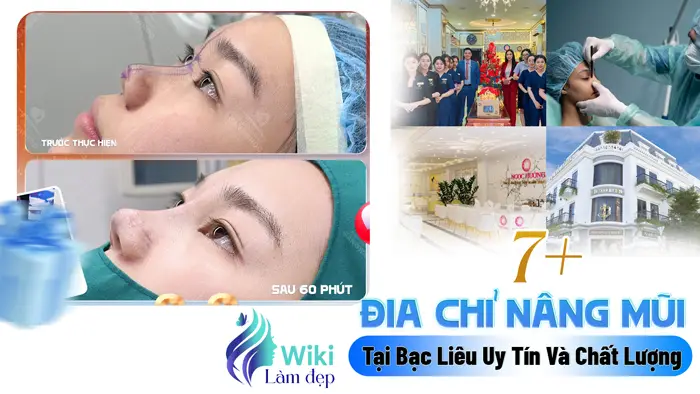 Top 7+ Địa Chỉ Nâng Mũi Tại Bạc Liêu Uy Tín Và Chất Lượng