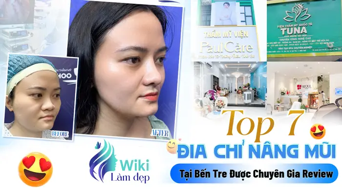 Top 7 Địa Chỉ Nâng Mũi Tại Bến Tre Được Chuyên Gia Review