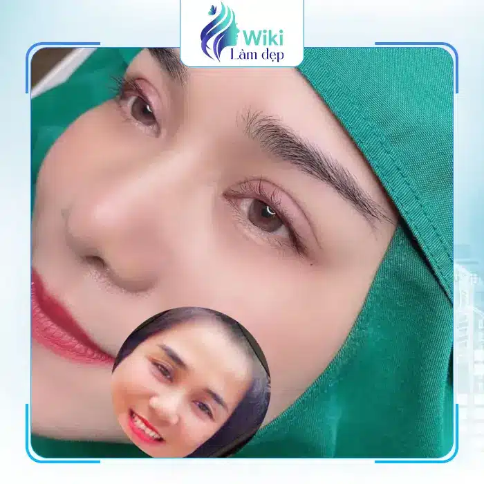 Review Chi Tiết: Top 7 Địa Chỉ Nâng Mũi tại Cao Bằng Uy Tín