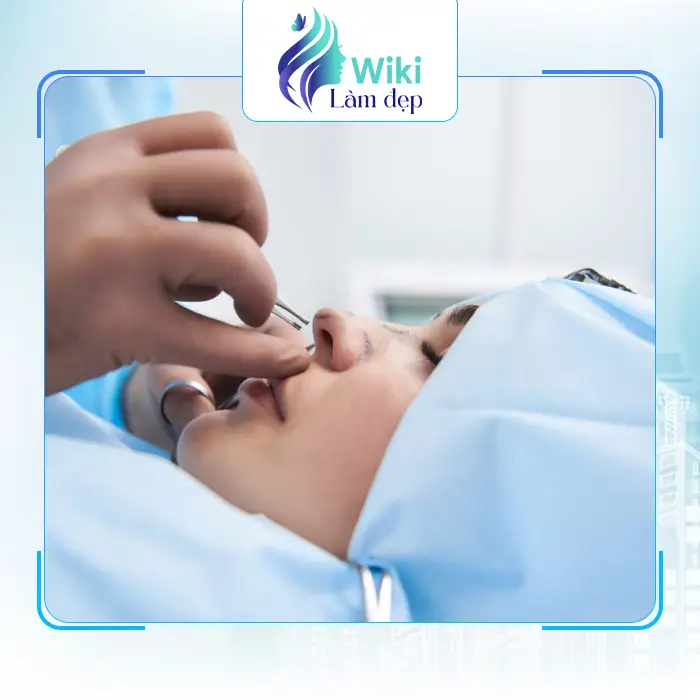 Top Địa Chỉ Nâng Mũi Tại Kon Tum Uy Tín, An Toàn Nhất Hiện Nay