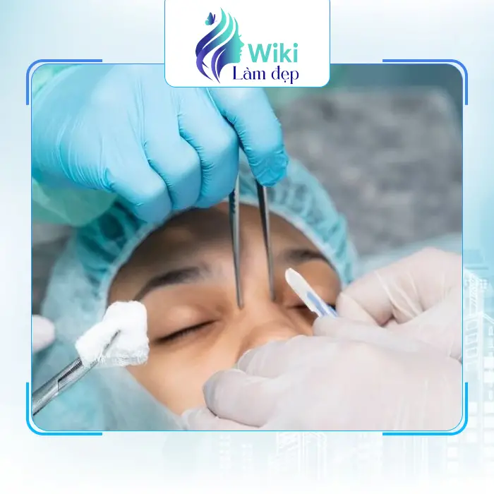 Top 7 Địa Chỉ Nâng Mũi Tại Lâm Đồng Đẹp Tự Nhiên & Bền Lâu