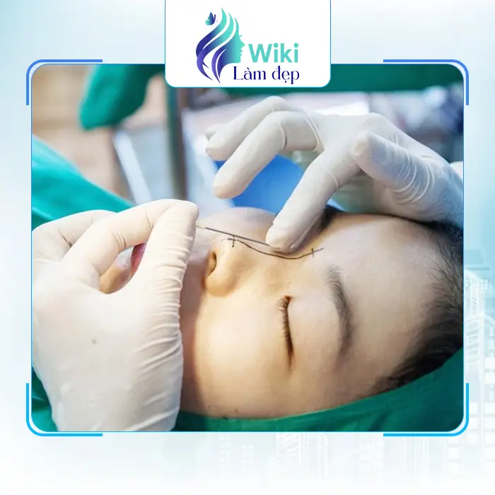 Top 7 Địa Chỉ Nâng Mũi Tại Lâm Đồng Đẹp Tự Nhiên & Bền Lâu