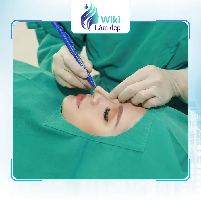 Top 7 Địa Chỉ Nâng Mũi Tại Lạng Sơn Uy Tín, An Toàn & Được Đánh Giá Cao