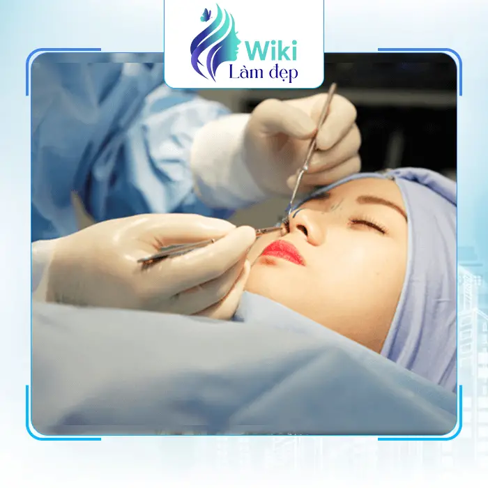 Review 7+ Địa Chỉ Nâng Mũi Tại Lào Cai Đáng Trải Nghiệm