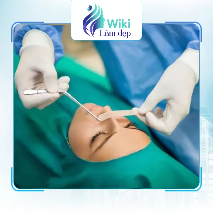 7 Địa Chỉ Nâng Mũi Tại Ninh Bình Uy Tín, An Toàn & Uy Tín