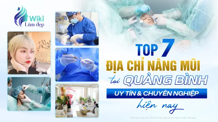 Top 7 Địa Chỉ Nâng Mũi Tại Quảng Bình Uy Tín & Chuyên Nghiệp Hiện Nay
