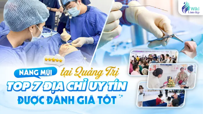 Nâng mũi tại Quảng Trị: Top 7 Địa Chỉ Uy Tín Được Đánh Giá Tốt