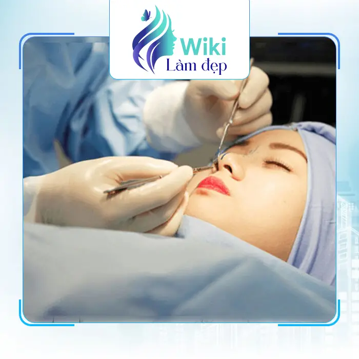 Top 7 Địa Chỉ Nâng Mũi Tại Ninh Thuận An Toàn – Hiệu Quả Cao