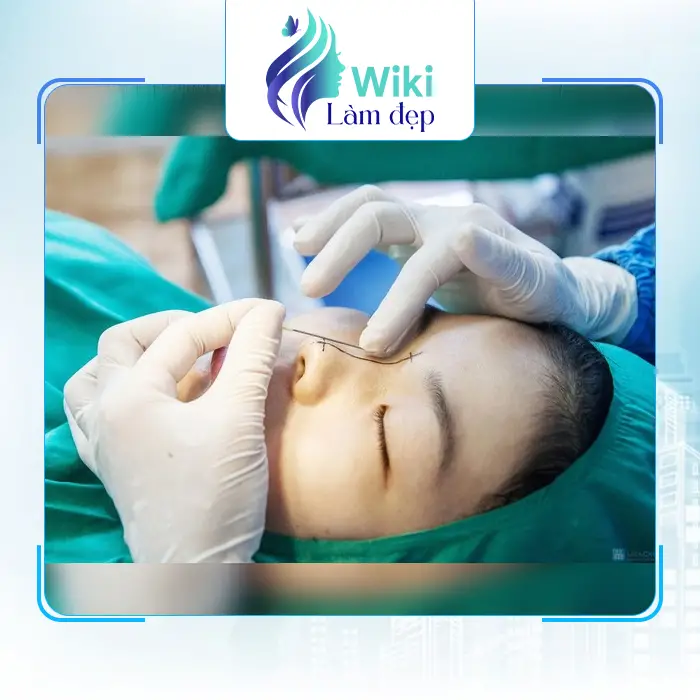 Danh Sách 7 Nơi Nâng Mũi Tại Sơn La: Lựa Chọn Thông Minh Cho Vẻ Đẹp Hoàn Hảo