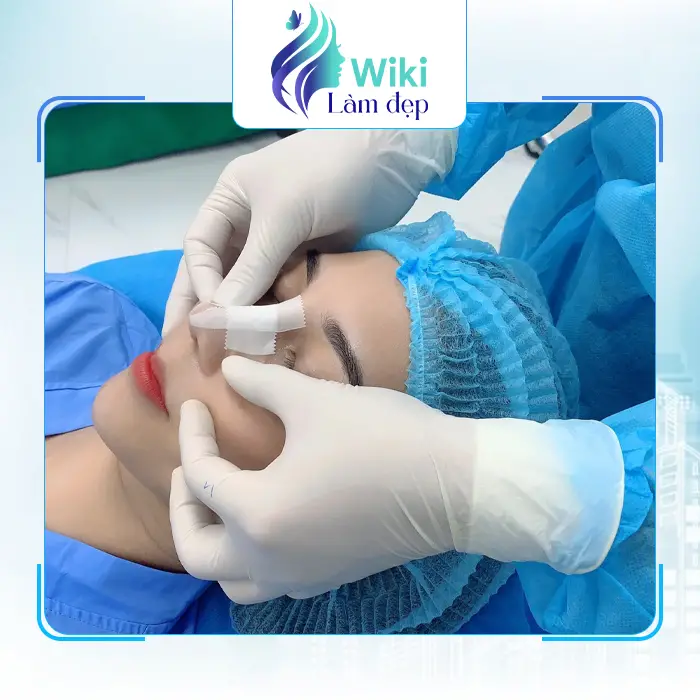 Top 7 Địa Chỉ Nâng Mũi Tại Thanh Hóa Được Đánh Giá Cao