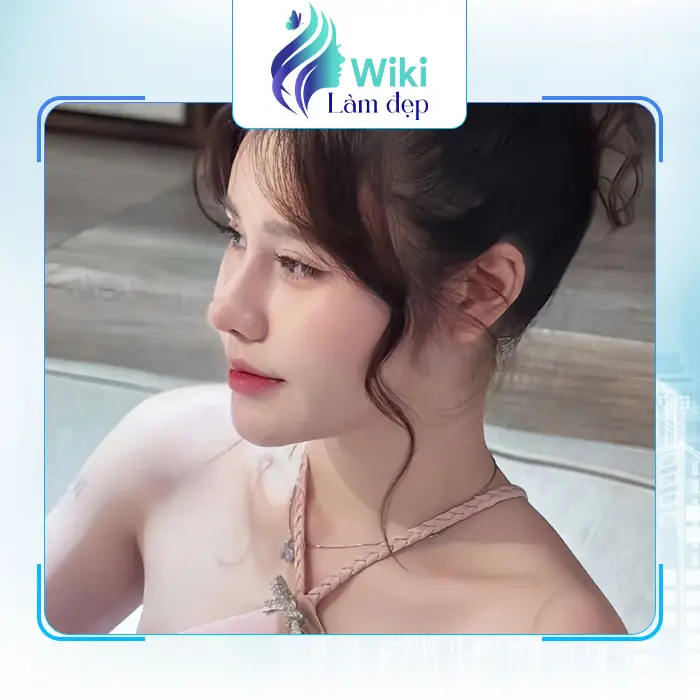 Top 7 Địa Chỉ Nâng Mũi Tại Thanh Hóa Được Đánh Giá Cao
