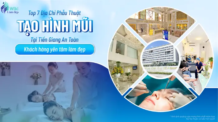 Top 7 Địa Chỉ Nâng Mũi Tại Tiền Giang An Toàn Khách Hàng Yên Tâm Làm Đẹp