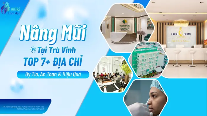 Nâng Mũi Tại Trà Vinh: Top 7+ Địa Chỉ Uy Tín, An Toàn & Hiệu Quả