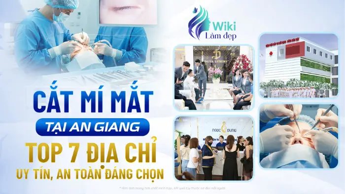 Cắt Mí Mắt Tại An Giang: Top 7 Địa Chỉ Uy Tín, An Toàn Đáng Chọn