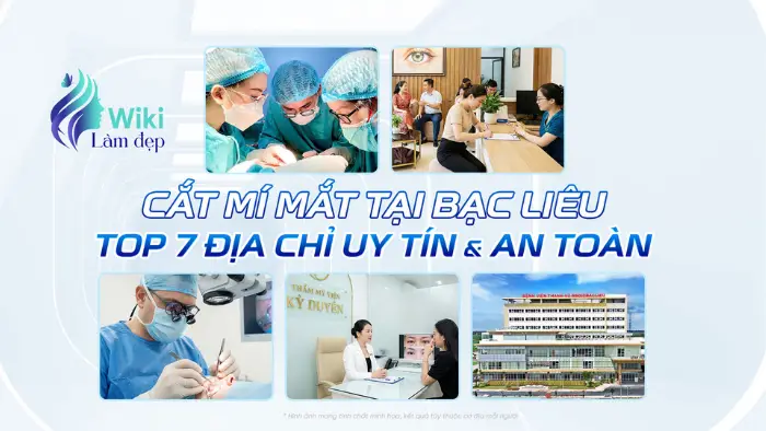Cắt Mí Mắt Tại Bạc Liêu: Top 7 Địa Chỉ Uy Tín & An Toàn