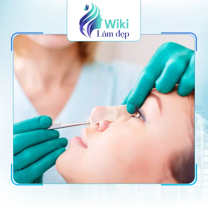 Top 7 Địa Chỉ Nâng Mũi Tại Quận Gò Vấp TP.HCM An Toàn & Đẹp Bền Lâu