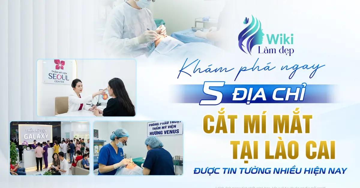 cắt mí mắt tại Lào Cai