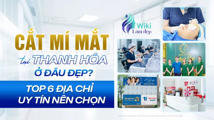 Cắt Mí Mắt Tại Thanh Hóa Ở Đâu Đẹp? Top 6 Địa Chỉ Uy Tín Nên Chọn