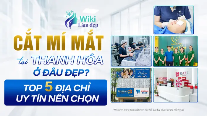 Cắt Mí Mắt Tại Thanh Hóa Ở Đâu Đẹp? Top 6 Địa Chỉ Uy Tín Nên Chọn