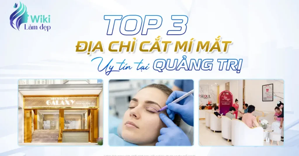 Top 3 địa chỉ cắt mí mắt uy tín tại Quảng Trị