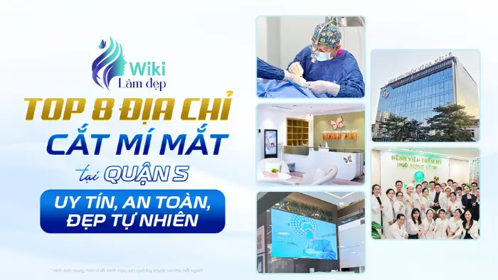 Top 8 địa chỉ cắt mí mắt tại Quận 5 uy tín, an toàn, đẹp tự nhiên