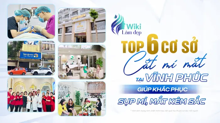 Top 6 cơ sở cắt mí mắt tại Vĩnh Phúc giúp khắc phục sụp mí, mắt kém sắc