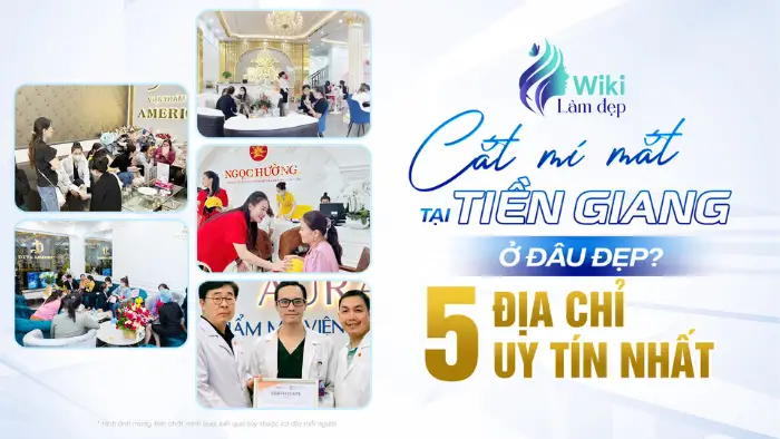 Cắt mí mắt tại Tiền Giang ở đâu đẹp? Top 5 địa chỉ uy tín nhất