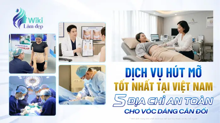 Dịch vụ hút mỡ tốt nhất tại Việt Nam – 5 địa chỉ an toàn cho vóc dáng cân đối