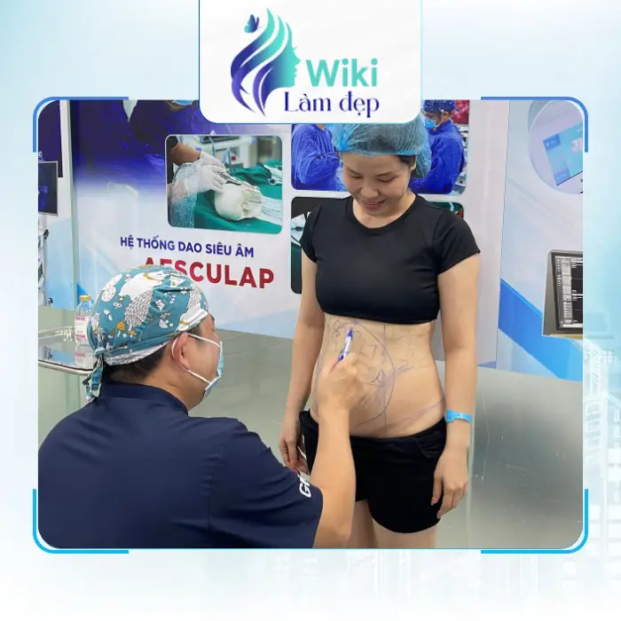 Dịch vụ hút mỡ tốt nhất tại Việt Nam – 5 địa chỉ an toàn cho vóc dáng cân đối