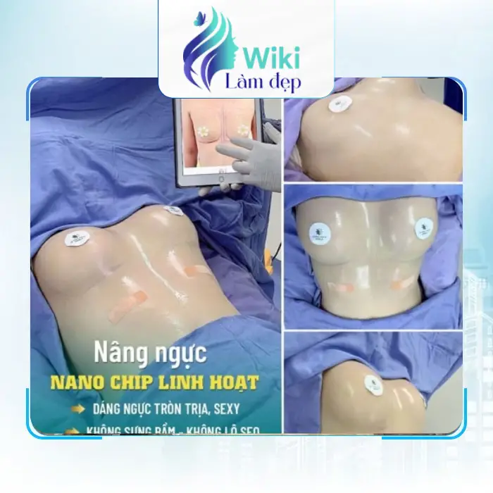 Nâng Ngực Tại An Giang Ở Đâu Tốt? Top 5 Địa Chỉ Uy Tín Hiện Nay