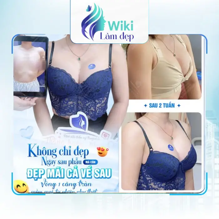 Nnâng ngực tại TPHCM