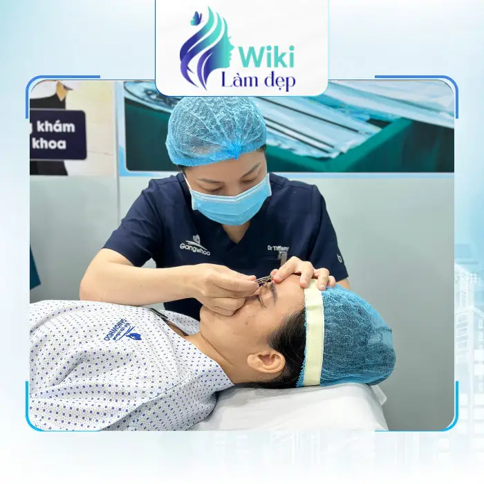 Review 4 Địa Chỉ Cắt Mí Mắt Tại Quận Tân Phú Đẹp, Tự Nhiên