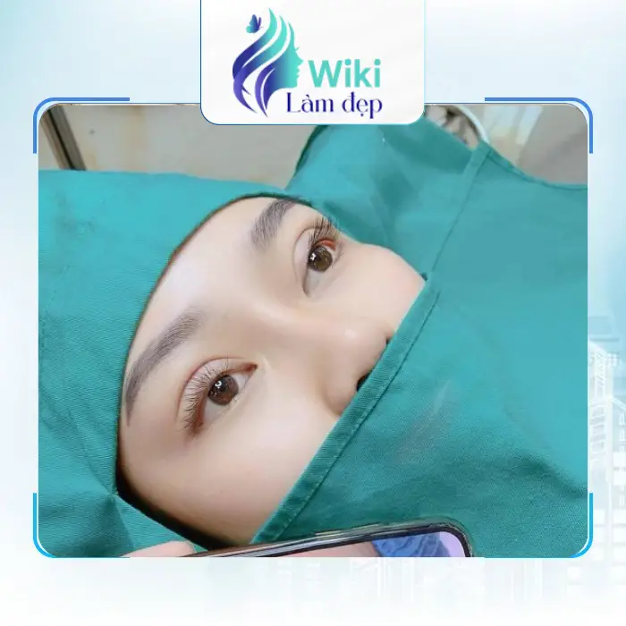 Review 4 Địa Chỉ Cắt Mí Mắt Tại Quận Tân Phú Đẹp, Tự Nhiên