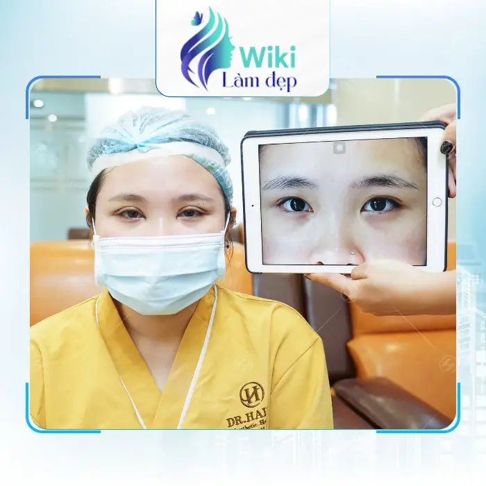 Top 4 địa chỉ cắt mí mắt Đẹp tại Thủ Đức được quan tâm