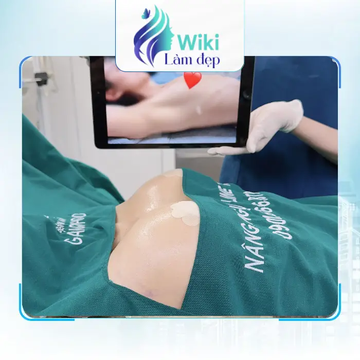 Khám Phá Địa Chỉ Nâng Ngực Tại Gia Lai Hiện Nay