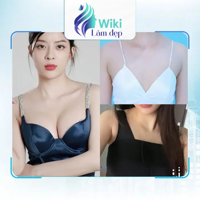 Nâng Ngực Tại Lâm Đồng Ở Đâu Uy Tín? Gợi Ý 6+ Địa Chỉ Được Nhiều Chị Em Quan Tâm