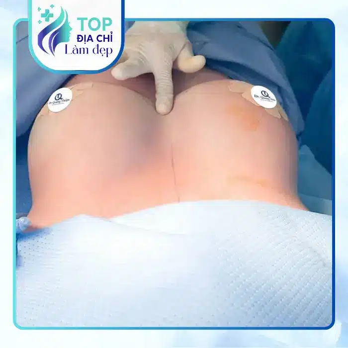 6 cơ sở nâng ngực tại Quận 5, TP.HCM uy tín hiện nay