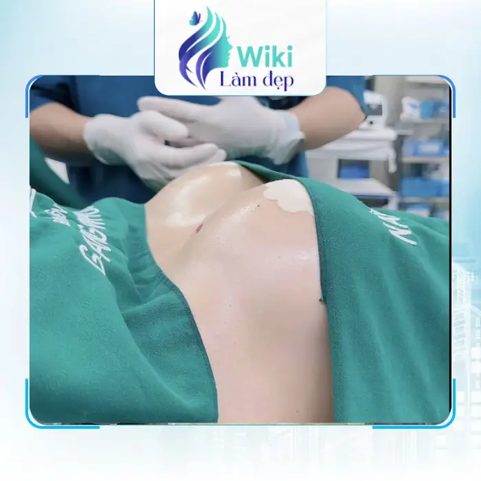Top 6 Địa Chỉ Nâng Ngực Quận Phú Nhuận An Toàn & Tự Nhiên