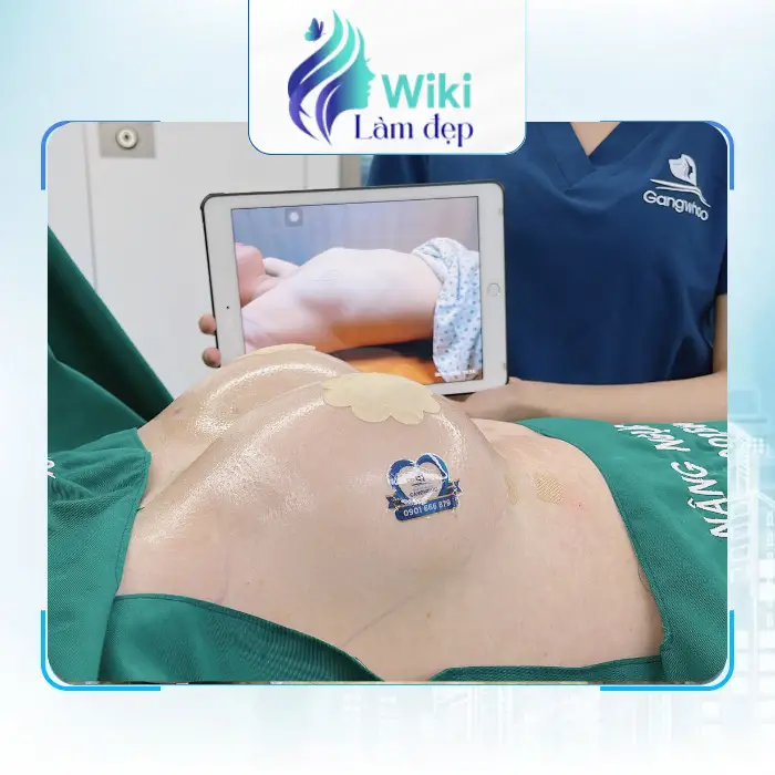 Tìm Hiểu 6 Địa Chỉ Nâng Ngực Tại Tiền Giang Hiện Nay