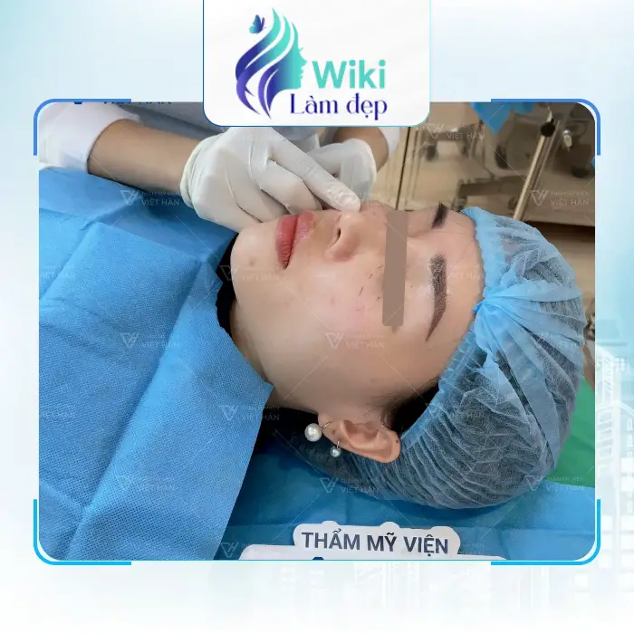 Căng Da Mặt Tại Thanh Hóa Tìm Hiểu 7 Địa Chỉ Chăm Sóc Da Và Trẻ Hóa 