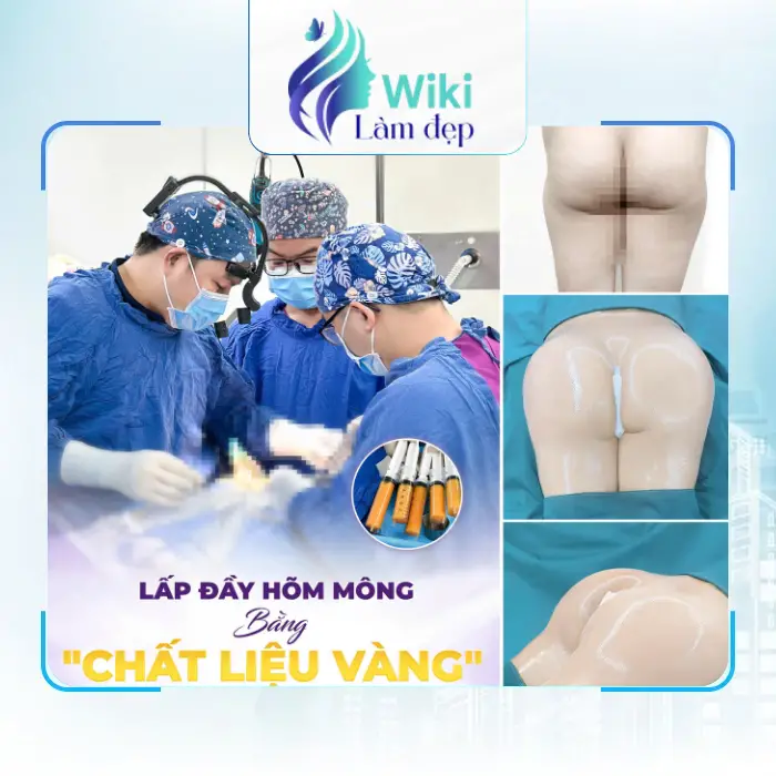 Nâng Mông Tại Bình Định – Tham Khảo 4 Địa Chỉ Được Quan Tâm