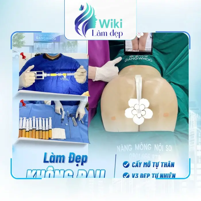 Nâng Mông Tại Bình Dương – 6 Địa Chỉ Lân Cận Được Quan Tâm
