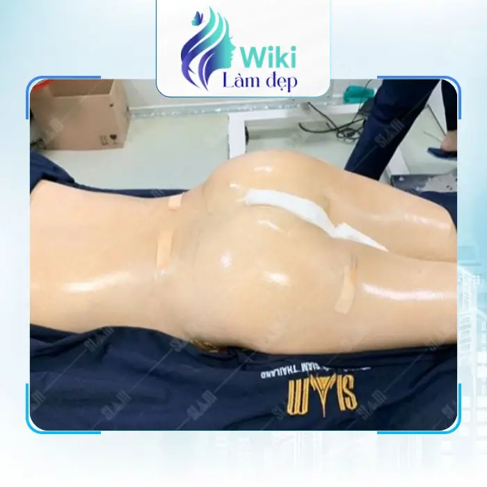 Nâng Mông Tại Bình Thuận – Tham Khảo 5 Địa Chỉ Lân Cận