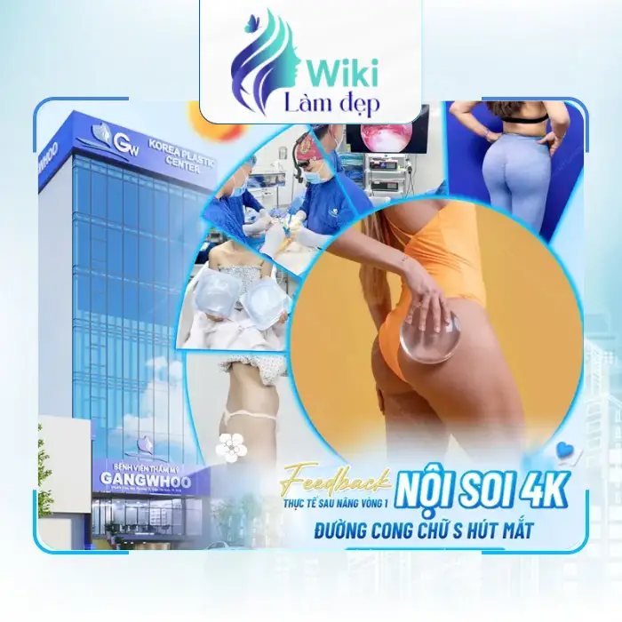 Nâng Mông Tại Đồng Nai – Gợi Ý Một Số Địa Chỉ Cải Thiện Vòng 3