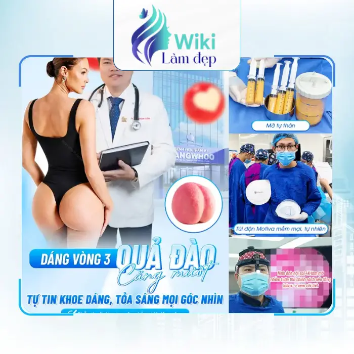 Nâng Mông Tại Quận 1 – Danh Sách Cơ Sở Để Tham Khảo