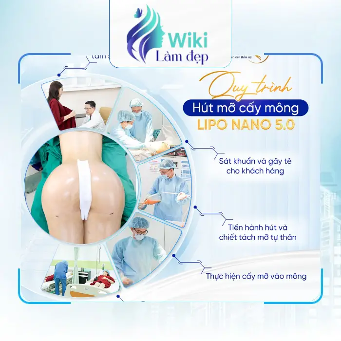 Nâng Mông Tại Quận 8 – Tham Khảo 6 Cơ Sở Tại TP.HCM