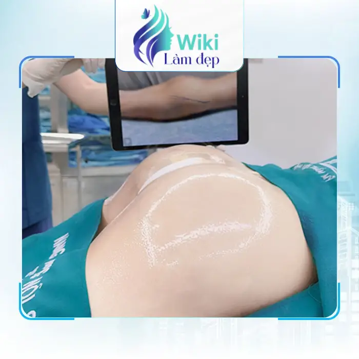 Nâng Mông Tại Tân Bình – Gợi Ý 4 Địa Chỉ Để Tham Khảo