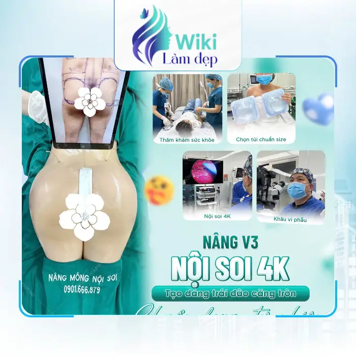 Nâng Mông Tại Thủ Đức – Tham Khảo 6 Cơ Sở Và Bác Sĩ Thẩm Mỹ